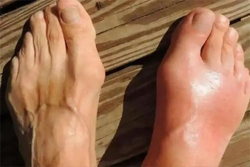 细节说明