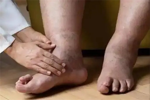 细节描述