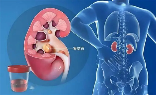 细节呈现