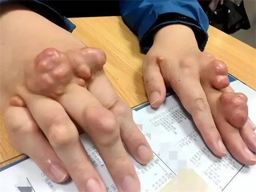 图片细节