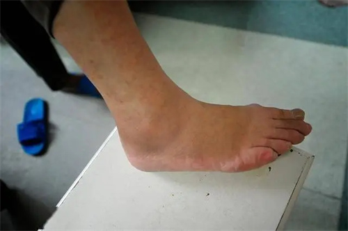 详细说明