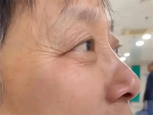 细节说明