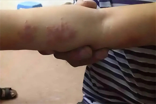 细节说明