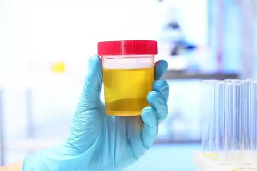 详细说明