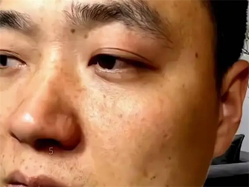 详细说明