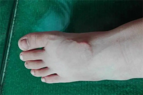 详细说明