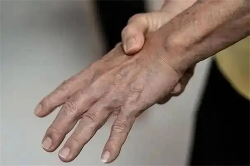细节介绍