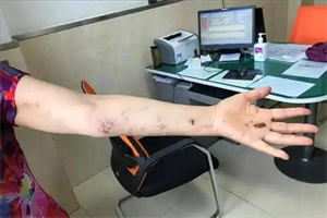 细节呈现