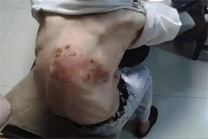 细节介绍
