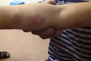 细节介绍