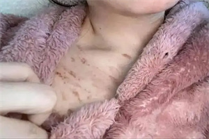 细节介绍