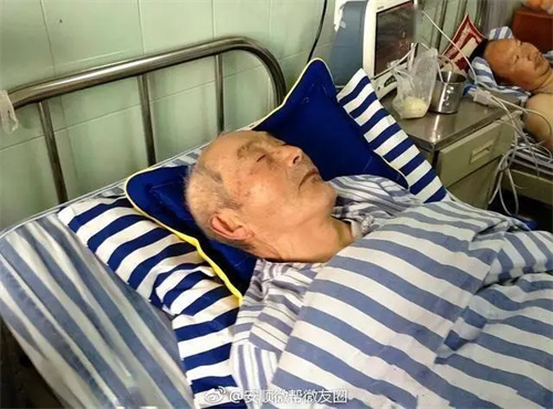 细节说明