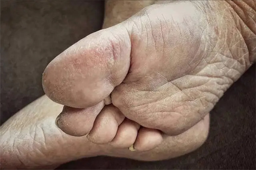 细节描述
