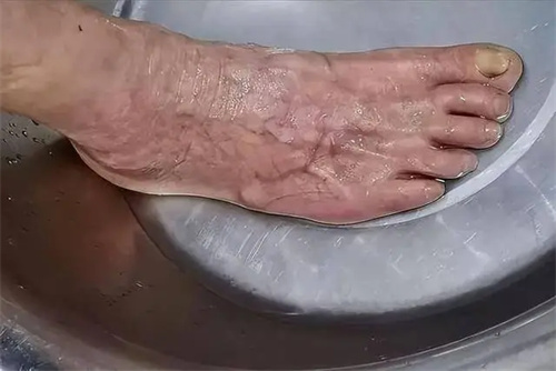 详细说明