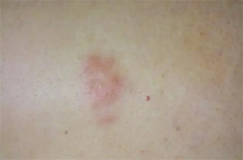 详细介绍