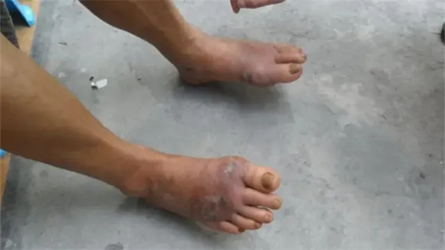 细节介绍