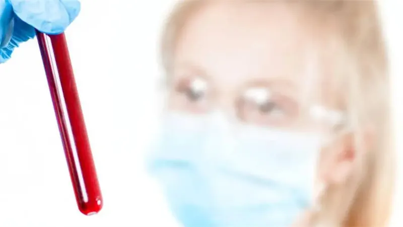 细节介绍